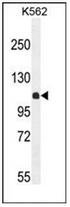 Western blot analysis of KIAA1324L Antibody (N-term) in K562 cell line lysates (35ug/lane). This demonstrates the KIAA1324L antibody detected the KIAA1324L protein (arrow)
