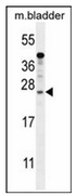 Western blot analysis of KIAA1644 antibody (N-term) in mouse bladder tissue lysates (35ug/lane). This demonstrates the KIAA1644 antibody detected the KIAA1644 protein (arrow).