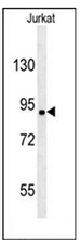 Western blot analysis of KIAA1680 Antibody (C-term) in Jurkat cell line lysates (35ug/lane). This demonstrates the KIAA1680 antibody detected the KIAA1680 protein (arrow).