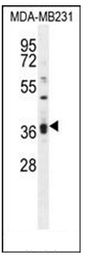 Western blot analysis of KLHL35 Antibody (C-term) in MDA-MB231 cell line lysates (35ug/lane). This demonstrates the KLHL35 antibody detected the KLHL35 protein (arrow).