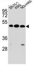 KREMEN2 Antibody (Center) western blot analysis in ZR-75-1, K562, NCI-H460 cell line lysates (35ug/lane).This demonstrates the KREMEN2 antibody detected the KREMEN2 protein (arrow).