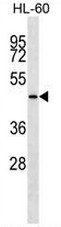 KRT28 Antibody (C-term) western blot analysis in HL-60 cell line lysates (35ug/lane).This demonstrates the KRT28 antibody detected the KRT28 protein (arrow).