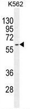 KRT73 Antibody (C-term) western blot analysis in K562 cell line lysates (35ug/lane).This demonstrates the KRT73 antibody detected the KRT73 protein (arrow).