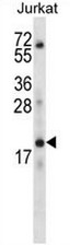 KRTAP13-3 Antibody (C-term) western blot analysis in Jurkat cell line lysates (35ug/lane).This demonstrates the KRTAP13-3 antibody detected the KRTAP13-3 protein (arrow).
