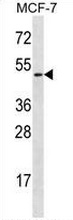 Western blot analysis in MCF-7 cell line lysates (35ug/lane) using Ladinin-1 antibody. (N-term). This demonstrates the Ladinin-1 antibody detected the LAD1 protein (arrow).
