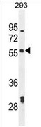Western blot analysis in 293 cell line lysates (35ug/lane) using LARP6 antibody. (N-term). This demonstrates the LARP6 antibody detected the LARP6 protein (arrow).