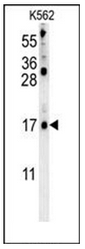 Western blot analysis of LCE2B Antibody (C-term) in K562 cell line lysates (35ug/lane). This demonstrates the LCE2B antibody detected the LCE2B protein (arrow).