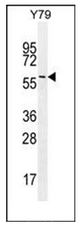 Western blot analysis of LENG9 Antibody (N-term) in Y79 cell line lysates (35ug/lane). This demonstrates the LENG9 antibody detected the LENG9 protein (arrow).