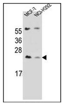 Western blot analysis of LIN7C Antibdy (C-term) in MCF-7, NCI-H292 cell line lysates (35ug/lane). This demonstrates the LIN7C antibody detected the LIN7C protein (arrow).
