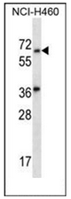 Western blot analysis of LINGO3 Antibody (C-term) in NCI-H460 cell line lysates (35ug/lane). This demonstrates the LINGO3 antibody detected the LINGO3 protein (arrow). Western blot analysis of LINGO3 Antibody (C-term) in NCI-H460 cell line lysates (35ug/lane). This demonstrates the LINGO3 antibody detected the LINGO3 protein (arrow).