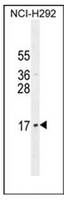 Western blot analysis of LLPH Antibody (Center) in NCI-H292 cell line lysates (35ug/lane). This demonstrates the LLPH antibody detected the LLPH protein (arrow).