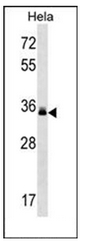 Western blot analysis of LMAN2 Antibody (C-term) in Hela cell line lysates (35ug/lane). This demonstrates the LMAN2 antibody detected the LMAN2 protein (arrow).