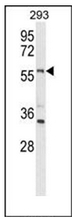 Western blot analysis of LMBR1L Antibody (C-term) in 293 cell line lysates (35ug/lane). LMBR1L (arrow) was detected using the purified Pab. Western blot analysis of LMBR1L Antibody (C-term) in 293 cell line lysates (35ug/lane). LMBR1L (arrow) was detected using the purified Pab.
