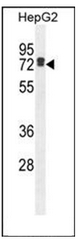 Western blot analysis of LRRC40 Antibody (C-term) in HepG2 cell line lysates (35ug/lane). This demonstrates the LRC40 antibody detected the LRRC40 protein (arrow).