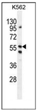 Western blot analysis of LRIT1 Antibody (C-term) in K562 cell line lysates (35ug/lane). This demonstrates the LRIT1 antibody detected the LRIT1 protein (arrow).