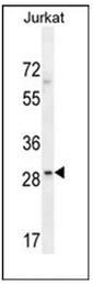 Western blot analysis of LRRC25 Antibody (C-term) in Jurkat cell line lysates (35ug/lane). This demonstrates the LRRC25 antibody detected the LRRC25 protein (arrow).