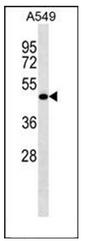 Western blot analysis of LRRC26 Antibody (C-term) in A549 cell line lysates (35ug/lane).This demonstrates the LRRC26 antibody detected the LRRC26 protein (arrow).