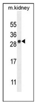 Western blot analysis of LYPD4 Antibody (Center) in mouse kidney tissue lysates (35ug/lane). This demonstrates the LYPD4 antibody detected the LYPD4 protein (arrow).