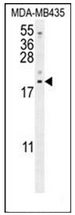 Western blot analysis of LYRM4 Antibody (Center) in MDA-MB435 cell line lysates (35ug/lane). This demonstrates the LYRM4 antibody detected the LYRM4 protein (arrow).