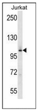 Western blot analysis of MAP4K2 Antibody (Center) in Jurkat cell line lysates (35ug/lane). This demonstrates the MAP4K2 antibody detected the MAP4K2 protein (arrow).