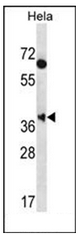 Western blot analysis of MBNL2 Antibody (C-term) in Hela cell line lysates (35ug/lane). This demonstrates the MBNL2 antibody detected the MBNL2 protein (arrow).