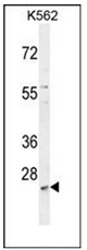 Western blot analysis of MCART2 Antibody (N-term) in K562 cell line lysates (35ug/lane). This demonstrates the MCART2 antibody detected the MCART2 protein (arrow).