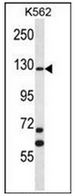 Western blot analysis of MCF2 Antibody (C-term) in K562 cell line lysates (35ug/lane). This demonstrates the MCF2 antibody detected the MCF2 protein (arrow).