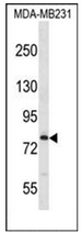 Western blot analysis of MED17 Antibody (Center) in MDA-MB231 cell line lysates (35ug/lane). This demonstrates the MED17 antibody detected the MED17 protein (arrow).