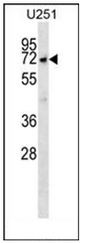 Western blot analysis of MKKS Antibody (C-term) in U251 cell line lysates (35ug/lane). This demonstrates the MKKS antibody detected the MKKS protein (arrow).