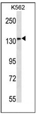 Western blot analysis of MN1 Antibody (Center) in K562 cell line lysates (35ug/lane). This demonstrates the MN1 antibody detected the MN1 protein (arrow).