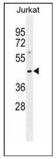 Western blot analysis of MOGT3 Antibody (C-term) in Jurkat cell line lysates (35ug/lane). This demonstrates the MOGT3 antibody detected the MOGT3 protein (arrow).