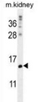 Western blot analysis in mouse kidney tissue lysates (35ug/lane) using MORN5 antibody. (C-term). This demonstrates this antibody detected the MORN5 protein (arrow).