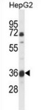 Western blot analysis of MOSC1 (arrow) in HepG2 cell line lysates (35ug/lane) using MOSC1 antibody.
