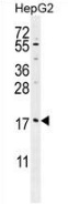 Western blot analysis in HepG2 cell line lysates (35ug/lane) using MRFAP1L1 antibody. This demonstrates this antibody detected the MRFAP1L1 protein (arrow).
