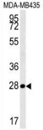 Western blot analysis in MDA-MB435 cell line lysates (35ug/lane) using MRM1 antibody. (N-term). This demonstrates this antibody detected the MRM1 protein (arrow).