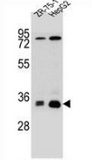 Western blot analysis in HepG2, ZR-75-1 cell line lysates (35ug/lane) using MTHFD2L antibody. (C-term). This demonstrates this antibody detected the MTHFD2L protein (arrow).