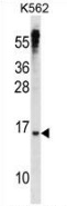 Western blot analysis in K562 cell line lysates (35ug/lane) using MAD3 antibody. (N-term). This demonstrates this antibody detected the MAD3 protein (arrow).