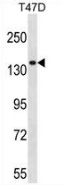 Western blot analysis in T47D cell line lysates (35ug/lane) using Myosin-Ie antibody. (N-term). This demonstrates this antibody detected the Myosin-Ieprotein (arrow).