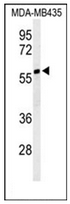 Western blot analysis of NARFL Antibody (Center) in MDA-MB435 cell line lysates (35ug/lane). NARFL (arrow) was detected using the purified Pab.