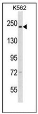 Western blot analysis of CAPD3 Antibody (C-term) in K562 cell line lysates (35ug/lane).