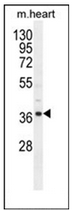 Western blot analysis of NDUF3 Antibody (N-term) in mouse heart tissue lysates (35ug/lane).This demonstrates the NDUF3 antibody detected the NDUF3 protein (arrow).