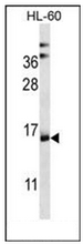 Western blot analysis of NDUFAF4 Antibody (N-term) in HL-60 cell line lysates (35ug/lane). This demonstrates the NDUFAF4 antibody detected the NDUFAF4 protein (arrow).