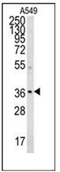Western blot analysis of Neugrin Antibody (C-term) in A549 cell line lysates (35ug/lane).