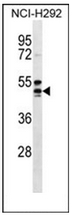 Western blot analysis of GPR109A Antibody (Center) in NCI-H292 cell line lysates (35ug/lane).