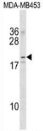 Western blot analysis in MDA-MB453 cell line lysates (35ug/lane) using NKAIN2 antibody. This demonstrates this antibody detected the NKAIN2 protein (arrow).