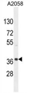 Western blot analysis in A2058 cell line lysates (35ug/lane) using NKAPL antibody. (C-term). This demonstrates this antibody detected the NKAPL protein (arrow).