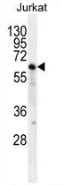 Western blot analysis in Jurkat cell line lysates (35ug/lane) using NKD2 antibody. (C-term). This demonstrates this antibody detected the NKD2 protein (arrow).