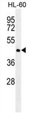 NR6A1 Antibody (N-term) western blot analysis in HL-60 cell line lysates (35ug/lane).This demonstrates the NR6A1 antibody detected the NR6A1 protein (arrow).
