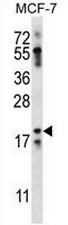 NRN1L Antibody (Center) western blot analysis in MCF-7 cell line lysates (35ug/lane).This demonstrates the NRN1L antibody detected the NRN1L protein (arrow).