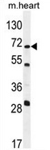 Western blot analysis in mouse heart tissue lysates (35ug/lane)using NT5C1B antibody. (N-term). This demonstrates the NT5C1B antibody detected the NT5C1B protein (arrow).